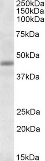 TIMM50 Polyclonal Antibody