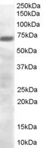 PRDM4 Polyclonal Antibody