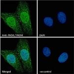 PADI4 Polyclonal Antibody