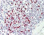 PADI4 Antibody in Immunohistochemistry (Paraffin) (IHC (P))