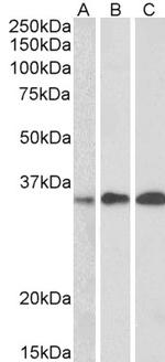 EFHD2 Polyclonal Antibody