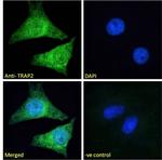 PSMD2 Polyclonal Antibody