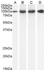 PSMD2 Antibody in Western Blot (WB)