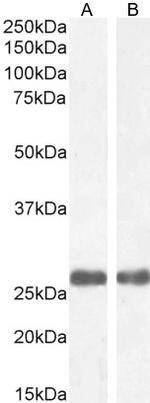 MBL2 Polyclonal Antibody