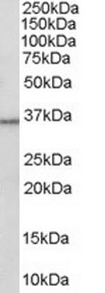 HSD11B1 Polyclonal Antibody