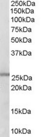 GSTM1/GSTM2 Antibody in Western Blot (WB)