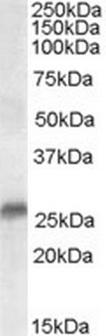 SRD5A2 Polyclonal Antibody