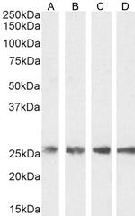 TPI1 Antibody in Western Blot (WB)