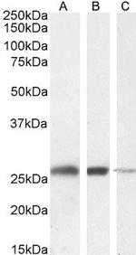 TPI1 Antibody in Western Blot (WB)