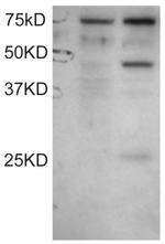 DYX1C1 Polyclonal Antibody