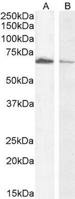Acetylcholinesterase Antibody in Western Blot (WB)