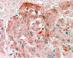SEMA3E Antibody in Immunohistochemistry (Paraffin) (IHC (P))