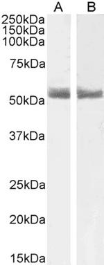 RARA Antibody in Western Blot (WB)
