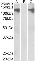 PUM2 Antibody in Western Blot (WB)
