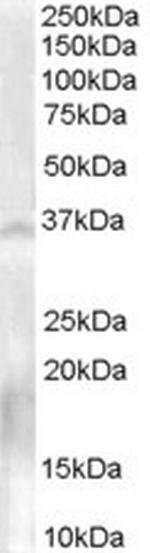 NANOS1 Polyclonal Antibody