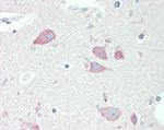 Neuroserpin Polyclonal Antibody