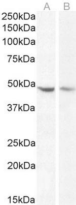 Neuroserpin Antibody in Western Blot (WB)