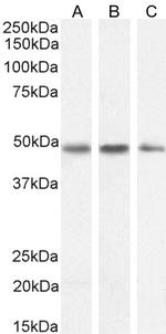 Neuroserpin Antibody in Western Blot (WB)