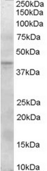 SERPINI2 Antibody in Western Blot (WB)