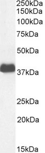 FCGR2B Antibody in Western Blot (WB)