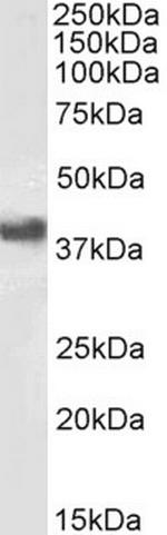 FCGR2B Antibody in Western Blot (WB)