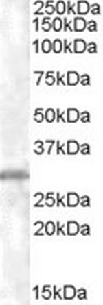 CHMP5 Polyclonal Antibody