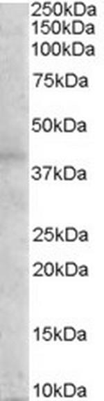 MC3R Polyclonal Antibody