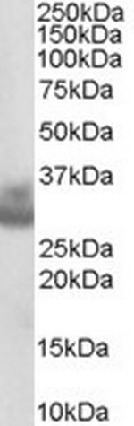 Cathepsin F Polyclonal Antibody