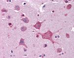 DPP10 Antibody in Immunohistochemistry (Paraffin) (IHC (P))