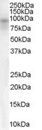DPP10 Antibody in Western Blot (WB)