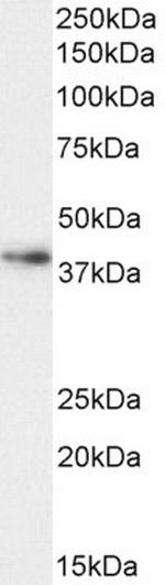 Arginase 1 Antibody in Western Blot (WB)