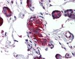 Mammaglobin A Antibody in Immunohistochemistry (Paraffin) (IHC (P))