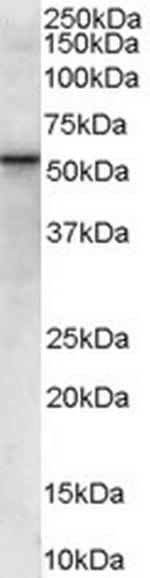 VPS45 Antibody in Western Blot (WB)