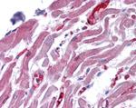 RAE1 Antibody in Immunohistochemistry (Paraffin) (IHC (P))