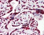 HMGA1 Antibody in Immunohistochemistry (Paraffin) (IHC (P))