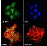 MEFV Polyclonal Antibody