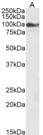 TRPC6 Polyclonal Antibody
