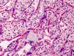 GDF15 Antibody in Immunohistochemistry (Paraffin) (IHC (P))