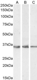 GDF15 Antibody in Western Blot (WB)