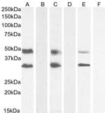 GDF15 Antibody in Western Blot (WB)
