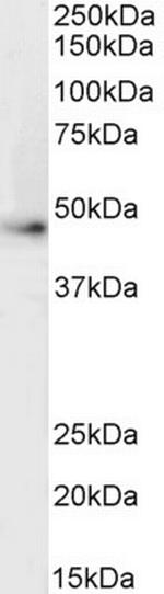beta-2 Adrenergic Receptor Antibody in Western Blot (WB)