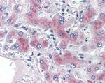 PCK1 Antibody in Immunohistochemistry (Paraffin) (IHC (P))
