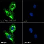 PCK2 Polyclonal Antibody