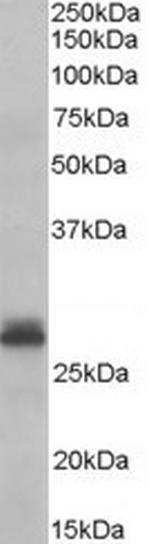 TAZ Polyclonal Antibody