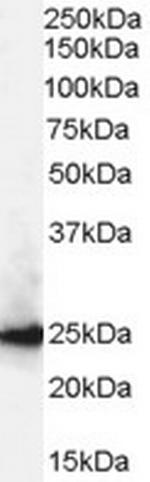 HP1 beta Antibody in Western Blot (WB)