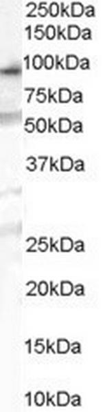 OSBPL10 Polyclonal Antibody