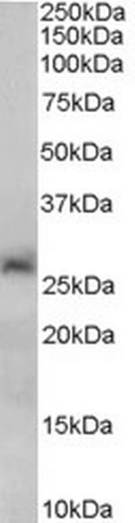 SIRT3 Polyclonal Antibody