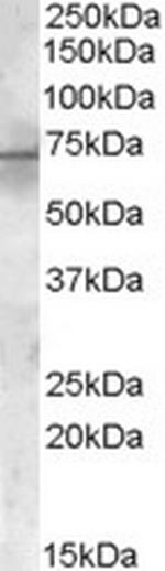 PDK1 Polyclonal Antibody