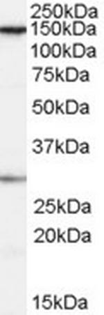 SUPT16H Antibody in Western Blot (WB)