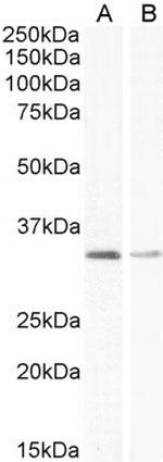 UCP1 Polyclonal Antibody
